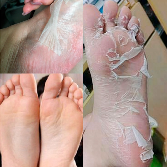 [BPOM] LANBENA Foot Peeling Mask Masker Kaki 1Pair Masker Kaki Remove Dead Skin Peeling Badan Foot Care Untuk Spa Kaki Exfloating