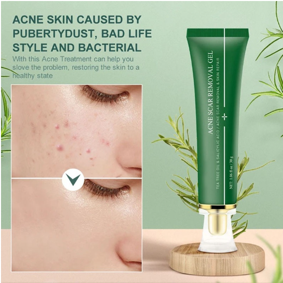 Breylee Acne Scar Removal Cream