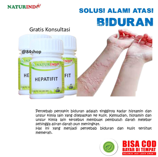 Obat Biduran