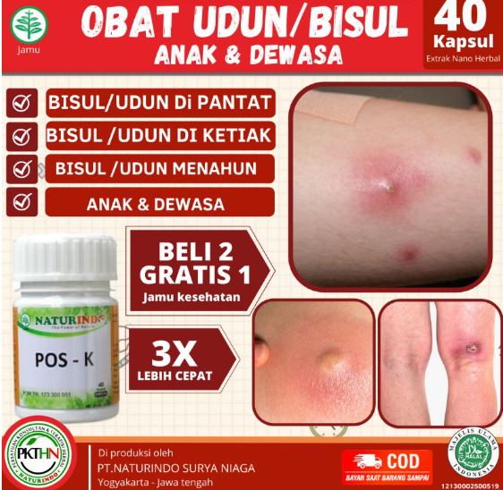 Obat Bisul